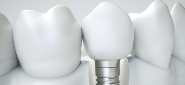 Услуги стоматолога