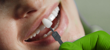 Услуги стоматолога