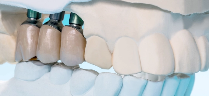 Услуги стоматолога