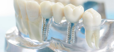 Услуги стоматолога